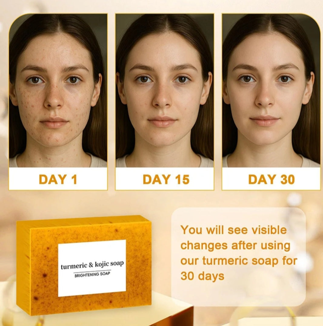 Kojic Acid & Tumeric Bar Soap